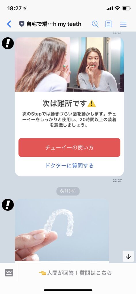 Oh my teethのマウスピース部分矯正は出っ歯・すきっ歯・ガタガタ歯に対応している