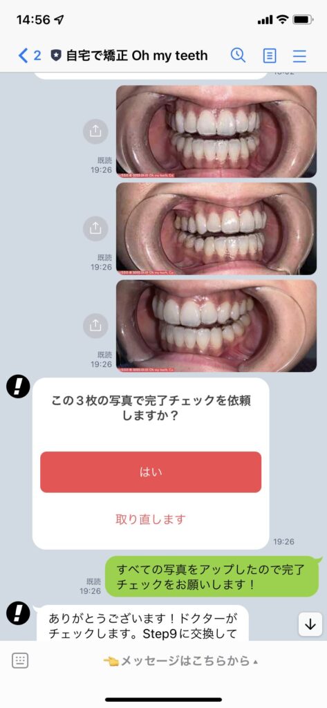 Oh my teethの始め方を分かりやすく解説