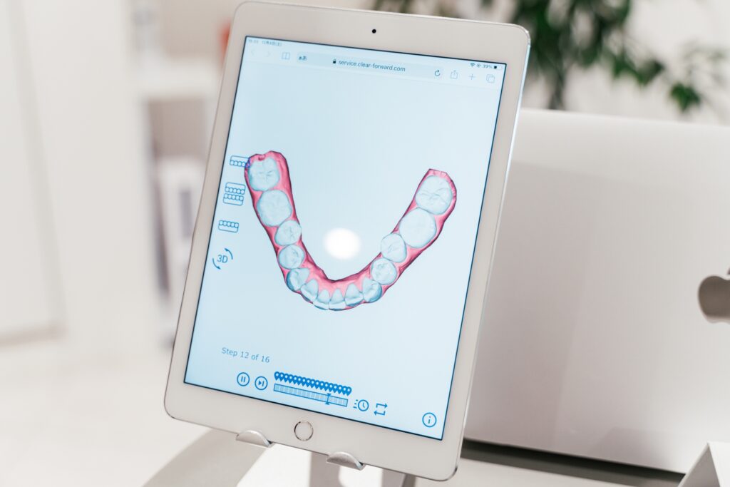 Oh my teeth東京銀座有楽町矯正歯科の口コミを調査した結果まとめ